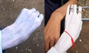 Kem dưỡng da Thái Lan gây tranh cãi vì độ trắng rợn người