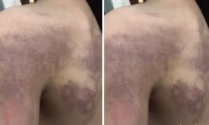 Cô giáo đánh học sinh do không làm được bài: Giám đốc Sở nói gì? 