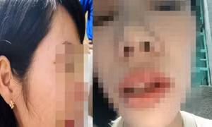 Đắk Nông chỉ đạo xử lý việc cô giáo bị hành hung
