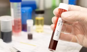 Người thứ 5 trên thế giới được chữa khỏi HIV 
