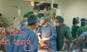 Cổ tích hiến tạng
