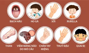 9 bệnh truyền nhiễm nguy hiểm phải cách ly y tế