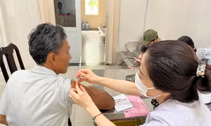 Khuyến cáo người dân chủ động tiêm phòng khi bị chó, mèo cắn