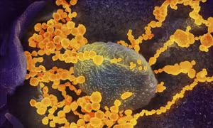Phát hiện 1 enzyme trong máu dẫn dắt virus SARS-CoV-2 xâm nhập các tế bào