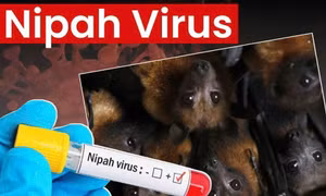 Bộ Y tế hướng dẫn chẩn đoán và điều trị bệnh do virus Nipah