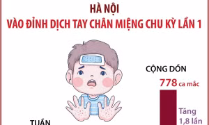 Hà Nội vào đỉnh dịch tay chân miệng chu kỳ lần 1