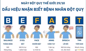 Quy tắc BE FAST: Dấu hiệu nhận biết sớm về đột quỵ