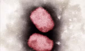 Chuyên gia Thái Lan khuyến nghị cảnh giác với biến thể mới của virus đậu mùa khỉ