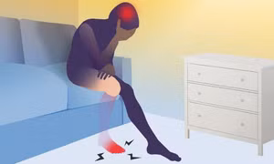 Bất ngờ bản đồ não ổn định khi mất chi, mở ra hướng điều trị đau chi ma