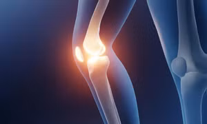 Thay đổi dáng đi giúp bảo vệ sụn gối thêm nhiều năm