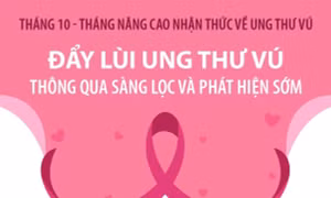 Đẩy lùi ung thư vú thông qua sàng lọc, phát hiện sớm