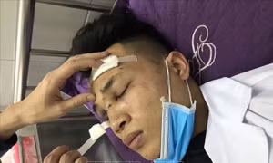 Bắt tạm giam các đối tượng hành hung bác sỹ ở Bình Giang, Hải Dương