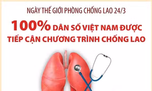 100% dân số Việt Nam được tiếp cận chương trình chống lao
