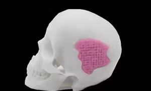 Công nghệ in 3D kính sinh học giúp xương tự phục hồi