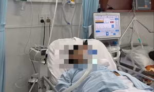 Cảnh báo ‘mùa cao điểm’ của bệnh viêm đường hô hấp do virus và vi khuẩn