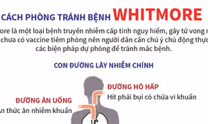 Cách phòng tránh bệnh Whitmore
