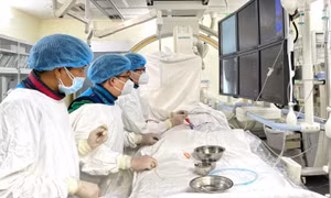 Nguy cơ đột quỵ não từ các động tác 'bẻ' cổ, gập ưỡn cổ, giác hơi trị liệu không đúng cách