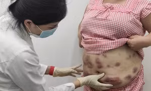 TP Hồ Chí Minh kiên quyết xử lý dịch vụ thẩm mỹ 'chui'
