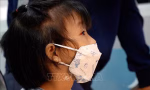 Sở Y tế TP Hồ Chí Minh bác bỏ thông tin sai lệch về bệnh đau mắt đỏ