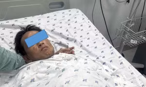 Bác sĩ cảnh báo trẻ dễ bị bỏng hoá chất vào dịp Tết 