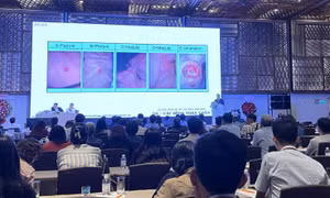 Tỷ lệ mắc bệnh tâm thần ngày càng tăng ở các bệnh nhân khám da liễu