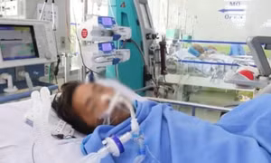Bệnh nhân bị rắn hổ mang chúa cắn vẫn phải lọc máu