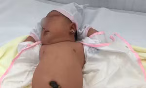 Bé gái sơ sinh có cân nặng 'khổng lồ'