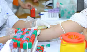 Hỗ trợ 6.500 xét nghiệm chẩn đoán Viêm gan B miễn phí cho người dân tại Hà Nội 