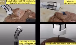 Cánh tay robot thu nhỏ giúp in 3D mô tế bào trực tiếp trong cơ thể