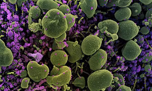 Sự biến đổi của virus SARS-CoV-2 mang ý nghĩa gì với con người?