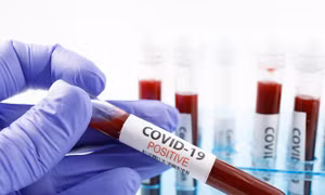 80% người mắc COVID-19 ở Thụy Điển vẫn còn kháng thể sau 1 năm