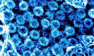 Virus SARS-CoV-2 thay đổi hình dạng để tăng khả năng sống sót