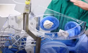 Thái Lan ra mắt bong bóng phòng COVID-19 cho nha sĩ đầu tiên trên thế giới