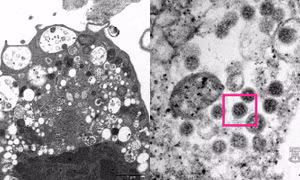 Vì sao virus HIV có thể đứng đằng sau sự xuất hiện của Omicron?