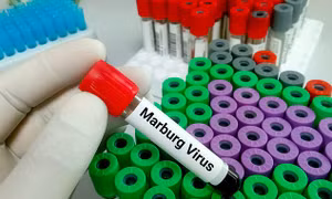 Rwanda triển khai thử nghiệm vaccine Marburg