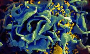 Ghi nhận biến thể mới của virus HIV tại Hà Lan