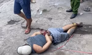 TP Hồ Chí Minh: Cướp điện thoại rồi kéo lê bé gái 13 tuổi trên đường