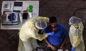 Singapore phát hiện biến thể của virus SARS-CoV-2 gây triệu chứng nhẹ hơn