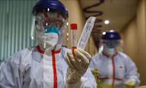 Đầu tư hàng triệu USD điều chế vaccine chống virus Corona chủng mới
