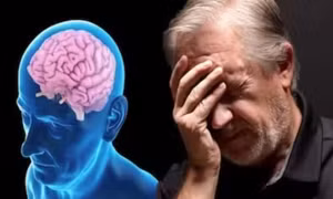 Australia công bố phát hiện mới về bệnh Alzheimer