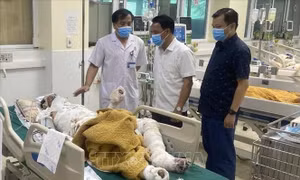 Hỗ trợ 3 bệnh nhân bị bỏng nặng khi tham gia chữa cháy rừng
