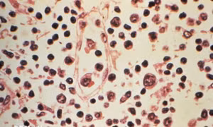 Gia tăng ca tử vong do virus Hanta, Chile ban bố cảnh báo y tế 