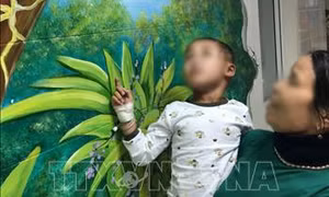 Điều trị thành công cho bệnh nhi bị vết thương sọ não hở