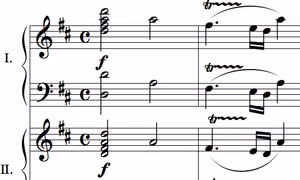 Phát hiện 'chìa khóa' trong bản nhạc của Mozart giúp xoa dịu người bệnh động kinh