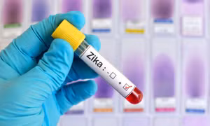 Campuchia phát hiện ca mắc virus Zika đầu tiên sau 7 năm