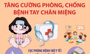 Tăng cường phòng, chống bệnh tay chân miệng trong thời gian tới