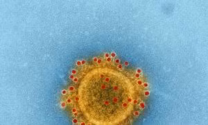Phát hiện một bệnh nhân nam Hàn Quốc nhiễm virus 'tử thần' gây nhiễm trùng phổi