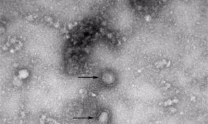 Xử lý nghiêm những đối tượng đăng thông tin sai về dịch bệnh virus Corona