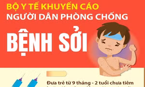 Bộ Y tế khuyến cáo người dân phòng bệnh sởi