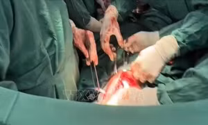 Kích hoạt 'báo động đỏ', cứu sống nam thanh niên bị thủng tim